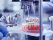 matériaux prothèses dentaires